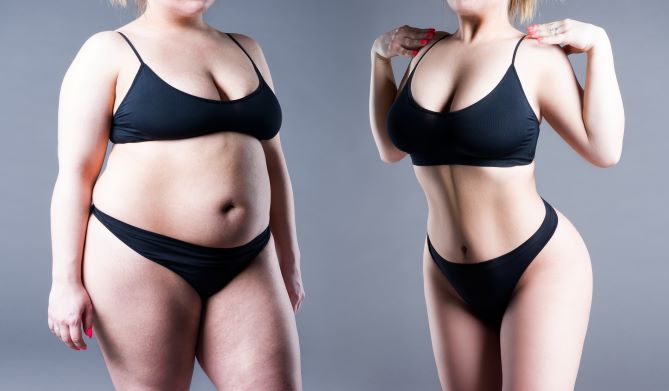 All You Need to Know About Weight Loss Surgeries